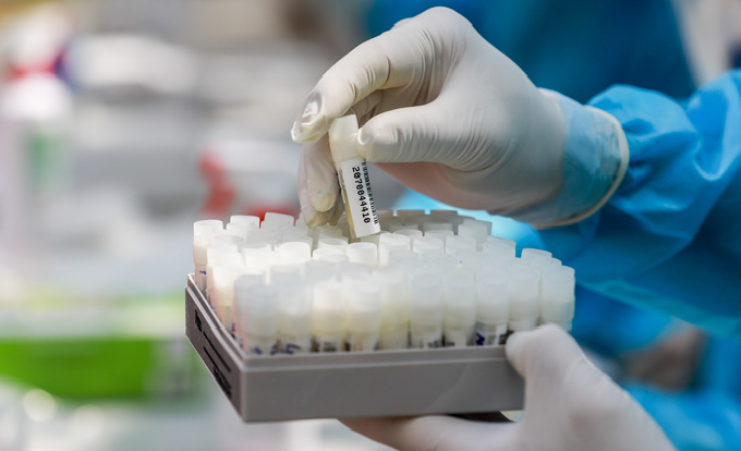 ho chi minh city provided with automated covid 19 testing system