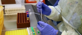 when coronavirus vaccines available for use