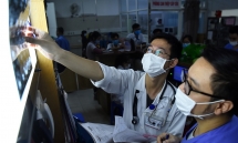 coronavirus update march 30 the numbers unstop worldwide most of developed countries suffer