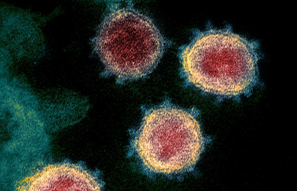 covid 19 patient remains may be contagious coroners case reveals