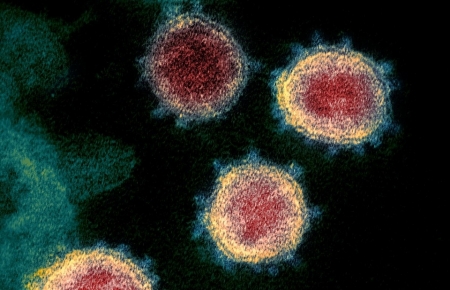 COVID-19 patient remains may be contagious, coroner’s case reveals