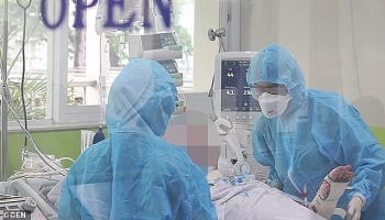 covid 19 lockdown will trigger health impacts researchers warn