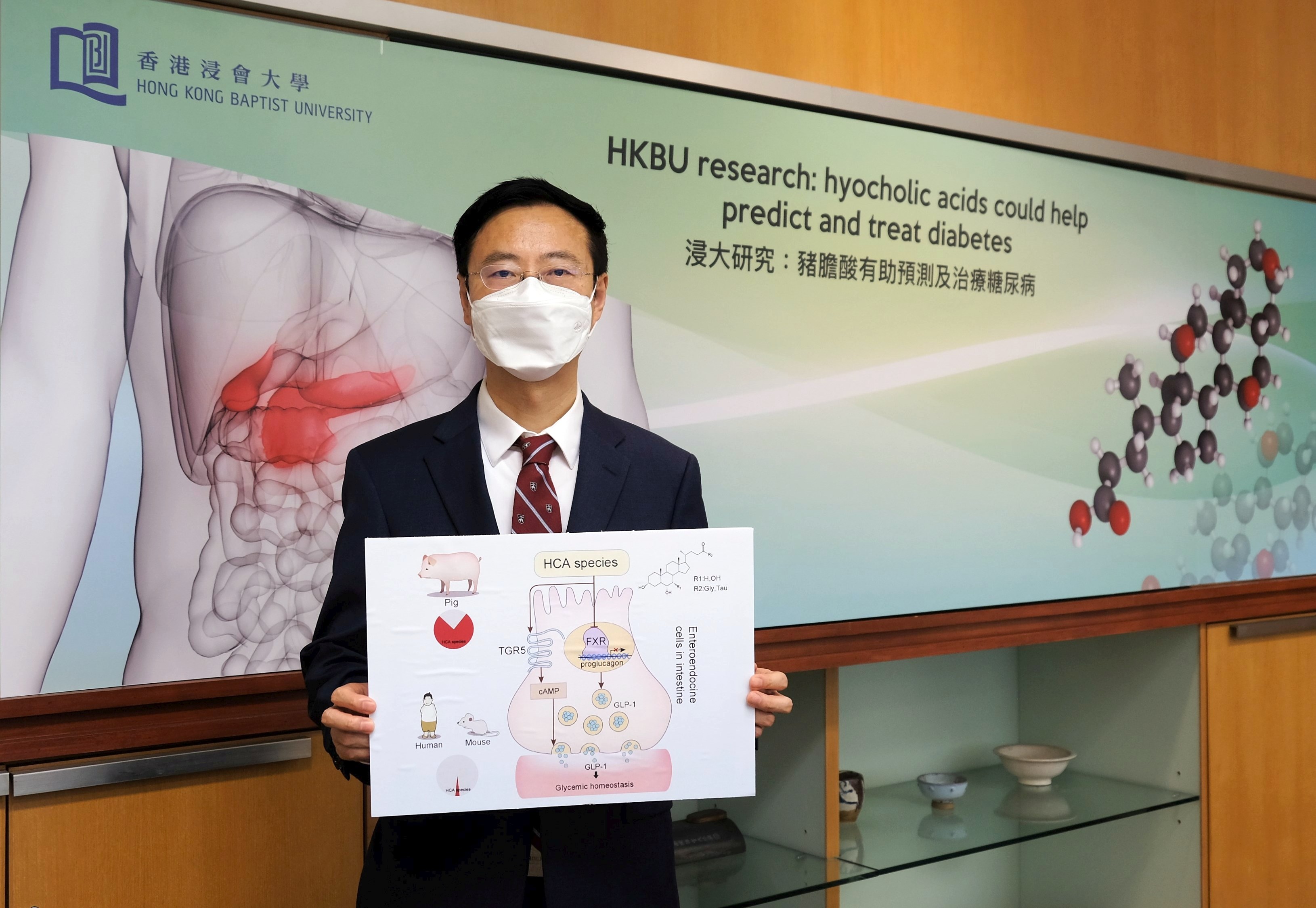 hong kong baptist university led research reveals hyocholic acids are promising agents for diabetes prediction and treatment