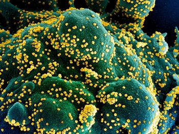 new reseach shows airdroplets from covid 19 patient can spread to 5 meters