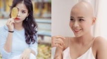 19 year old girl with cancer attends beauty pageant to spread optimism